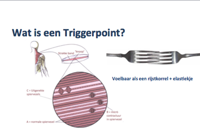 Triggerpoint